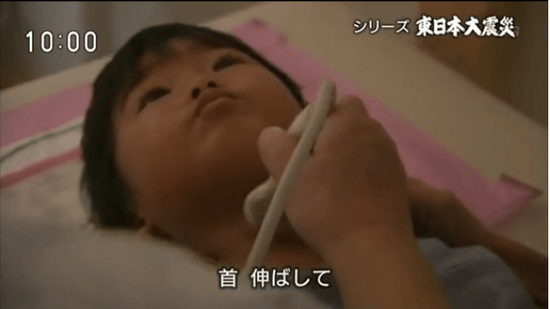 甲状腺検査