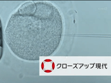 遺伝子を自在に操ることがきる「ゲノム編集」の可能性と課題／NHK・クローズアップ現代「“いのち”を変える新技術 ～ゲノム編集　最前線～」