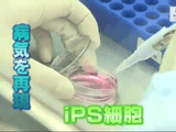 iPS細胞が変える “薬の常識” ～最前線からの報告～／NHK・クローズアップ現代